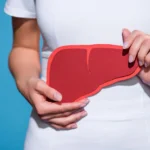 Gordura no fígado: como a obesidade pode levar à MASH e à esteatose hepática